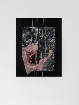 „Skauda / It hurts“